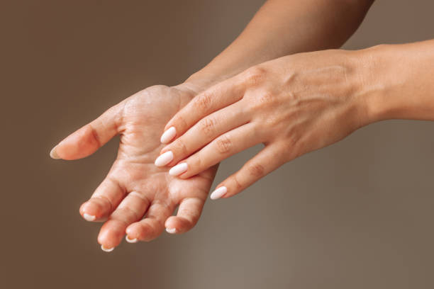 Hiperhidrosis
